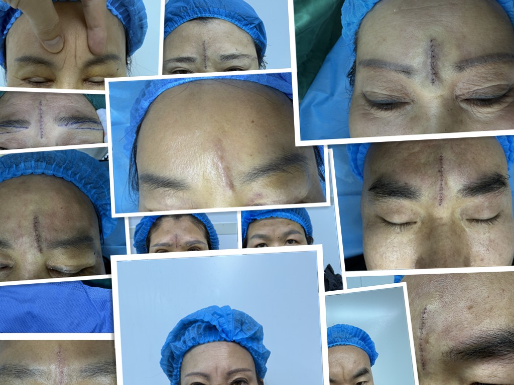 2025 06 14 09 53 28 IMG 2618 副本