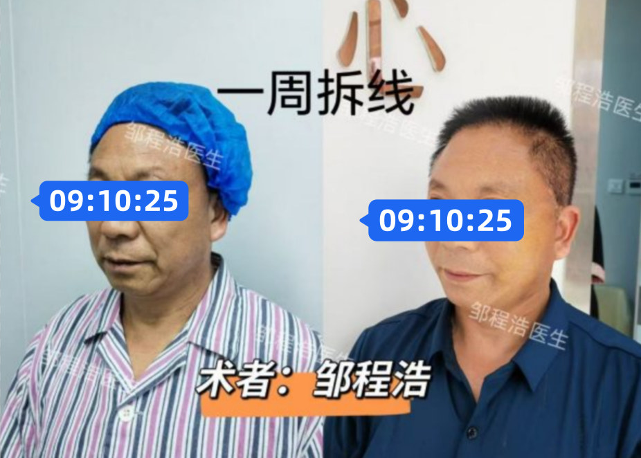 fc0cf097 7da8 45a0 a4ee b0f59d5ed958 opt